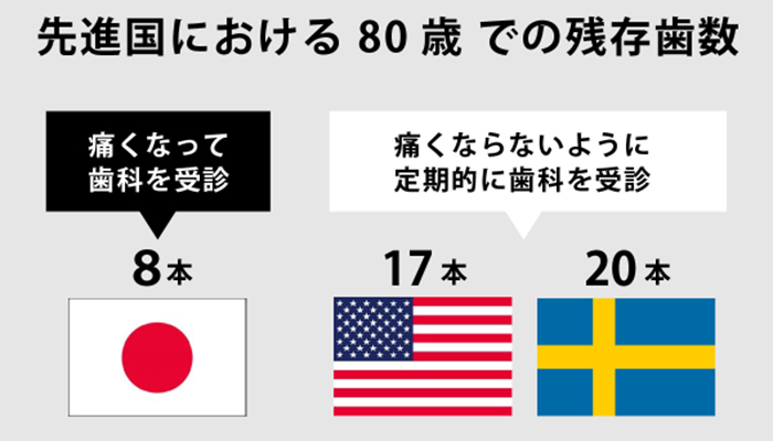 日本と欧米の比較